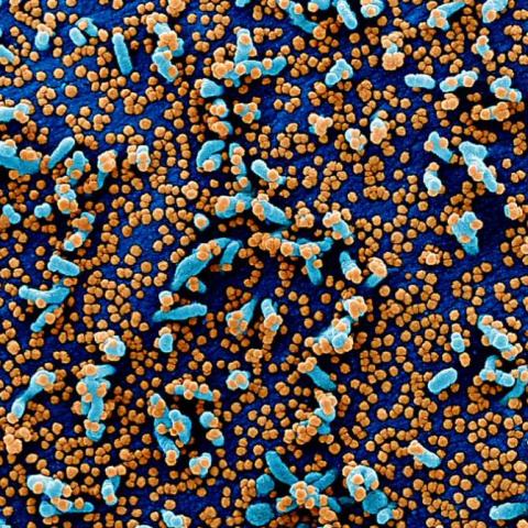 Neutralización llamativa del sistema inmunitario por el virus de la COVID-19