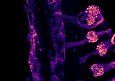 Distintas vías sensoriales para detectar el frío