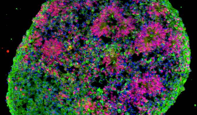 Con la nueva técnica es posible obtener una versión miniaturizada de la región cerebral conocida como cerebro anterior. (Imagen: Yale School of Medicine)